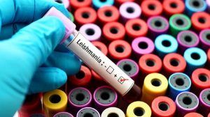 Analisis Leishmaniasis en Palma