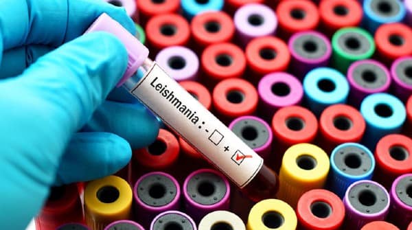 Analisis Leishmaniasis en Palma